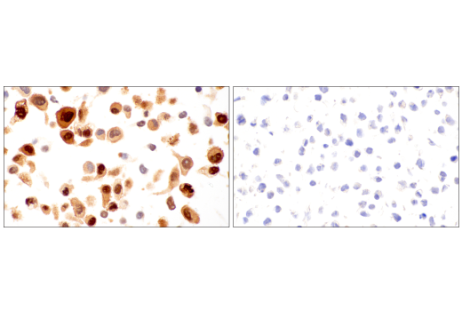Immunohistochemistry Image 6: TAZ (E9J5A) Rabbit Monoclonal Antibody (BSA and Azide Free)