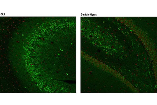 Immunofluorescence Image 1: Huntingtin (D7F7) XP<sup>®</sup> Rabbit mAb (BSA and Azide Free)