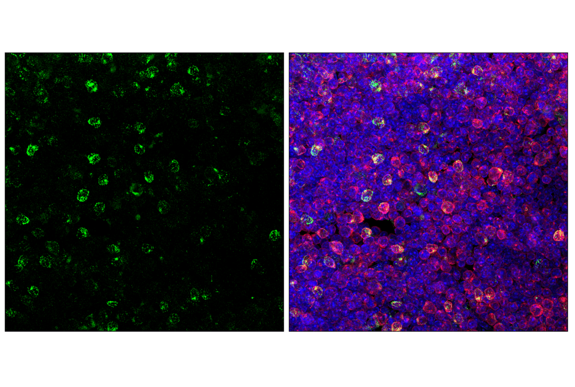 Immunofluorescence Image 1: CTLA-4 (E2V1Z) Rabbit Monoclonal Antibody