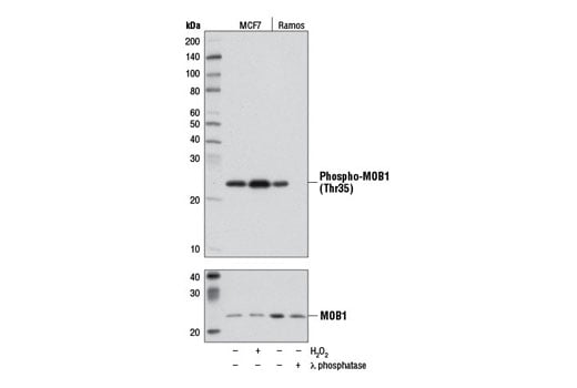 undefined Image 10: Hippo Signaling Antibody Sampler Kit