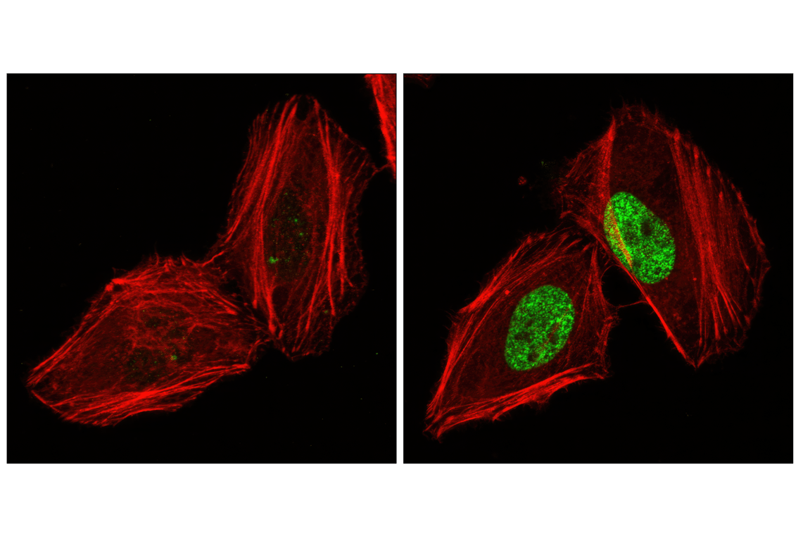 undefined Image 25: DNA Damage Antibody Sampler Kit