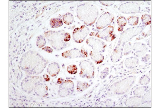 Immunohistochemistry Image 4: Notch1 (D1E11) Rabbit Monoclonal Antibody