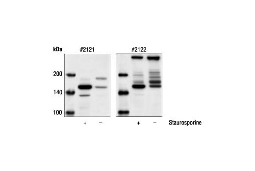 Western Blotting Image 1: Alpha-Fodrin Antibody