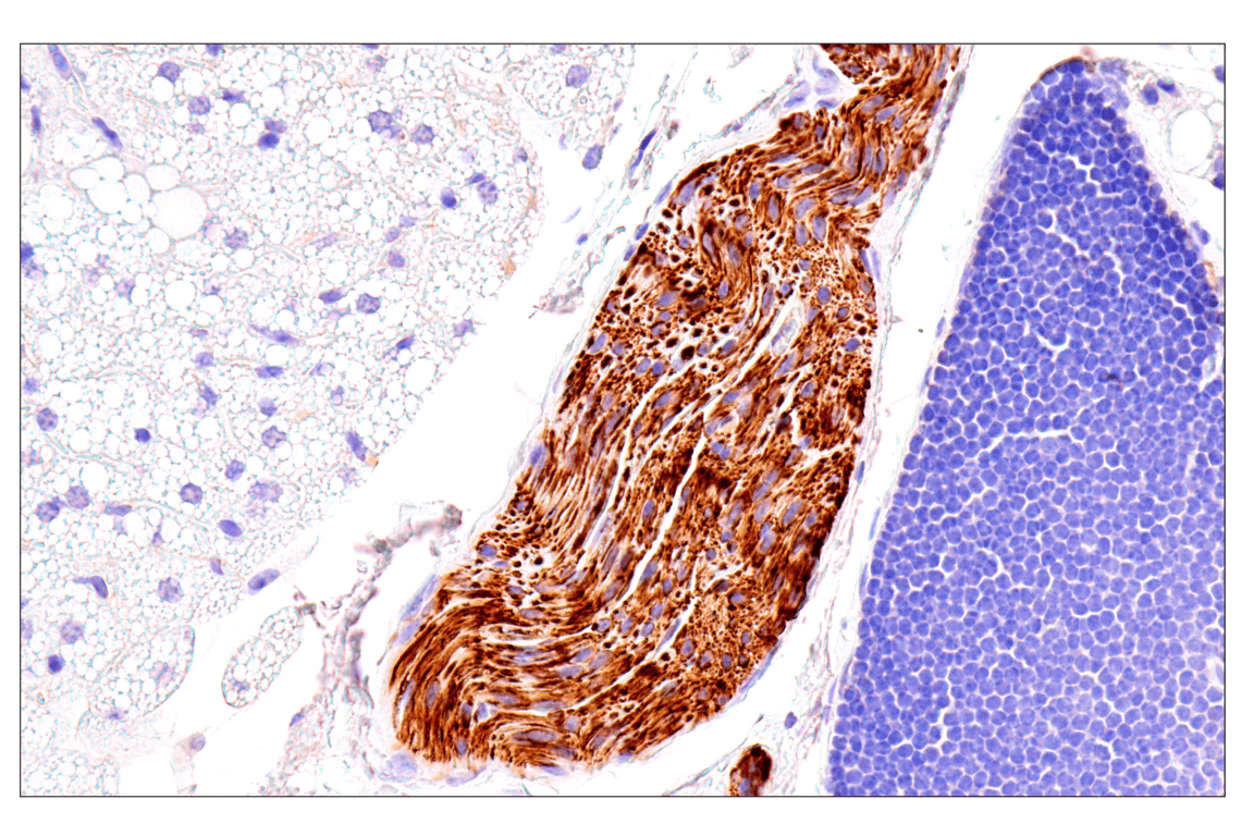 Immunohistochemistry Image 7: Neurofilament-M (E7L2T) Rabbit Monoclonal Antibody (BSA and Azide Free)