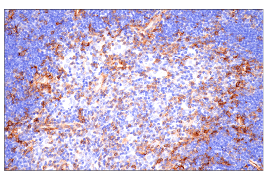 Immunohistochemistry Image 6: CD38 (E9F5A) Rabbit Monoclonal Antibody