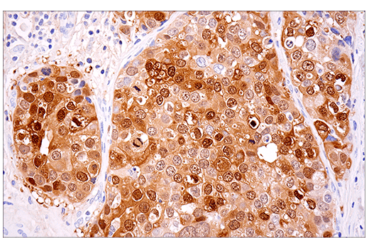Immunohistochemistry Image 8: Calretinin (E7R6O) Rabbit Monoclonal Antibody