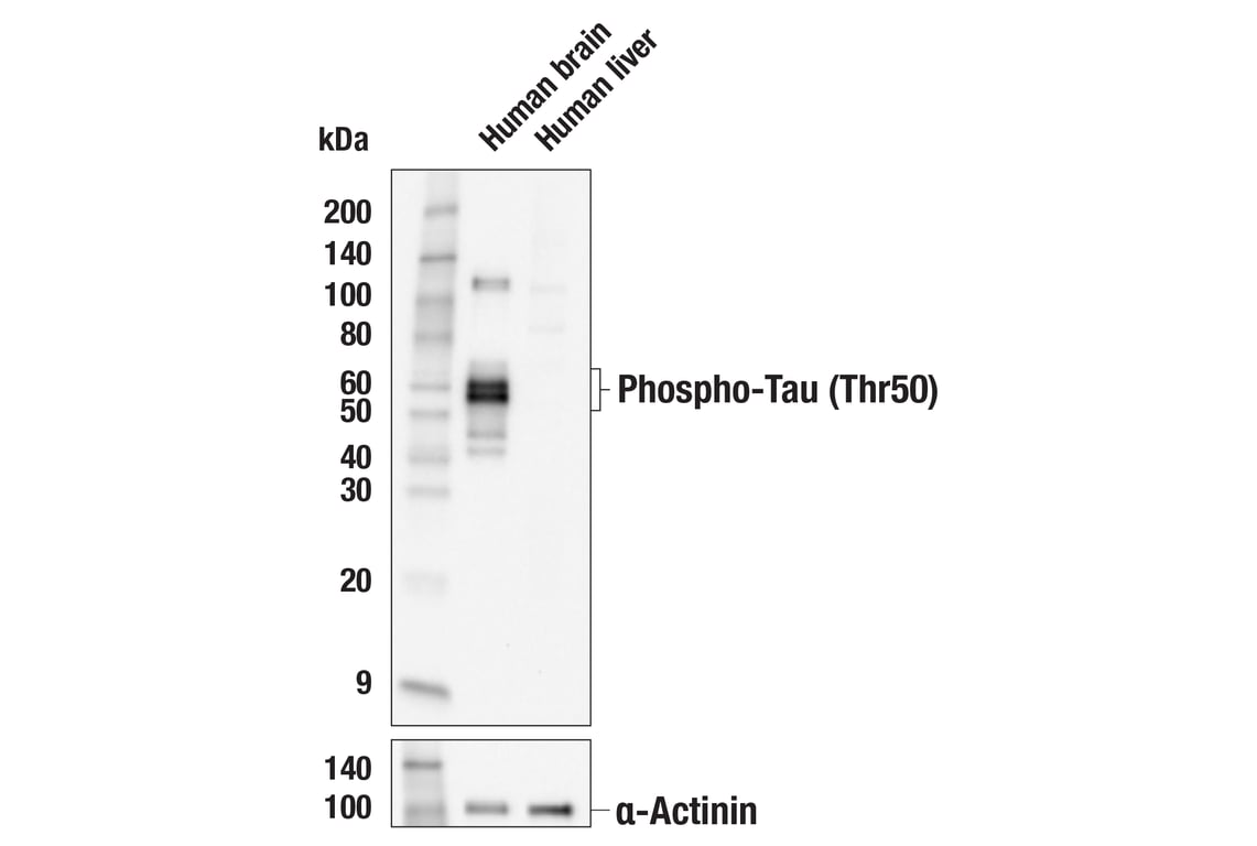 Western Blotting Image 1: Phospho-Tau (Thr50) (F9Y2M) Rabbit mAb