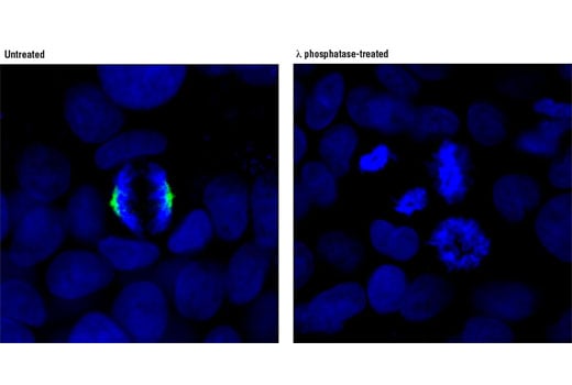 Immunofluorescence Image 1: Phospho-TACC3 (Ser558) (D8H10) Rabbit Monoclonal Antibody