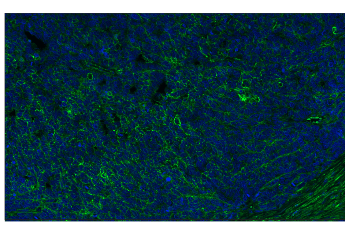 Immunohistochemistry Image 2: CD44 (E7K2Y) XP<sup>®</sup> Rabbit mAb (Alexa Fluor<sup>®</sup> 488 Conjugate)