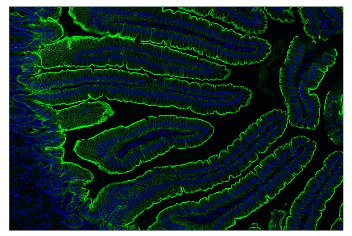 Immunohistochemistry Image 2: Keratin 17/19 (D4G2) Rabbit Monoclonal Antibody (Alexa Fluor<sup>®</sup> 488 Conjugate)