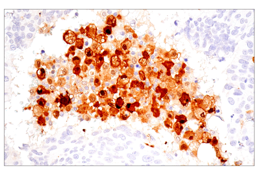 Immunohistochemistry Image 3: IL-18 (E3G8R) Rabbit Monoclonal Antibody (BSA and Azide Free)
