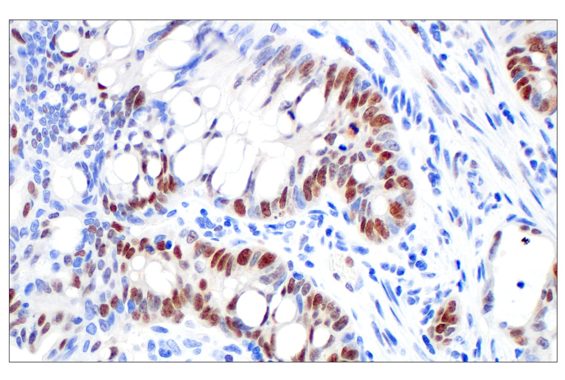 Immunohistochemistry Image 3: BRCA1 (E5S9G) Rabbit mAb (BSA and Azide Free)