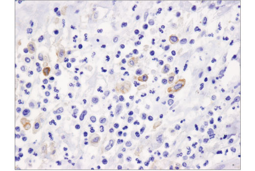 Immunohistochemistry Image 1: PD-L2 (D7U8C) Rabbit Monoclonal Antibody