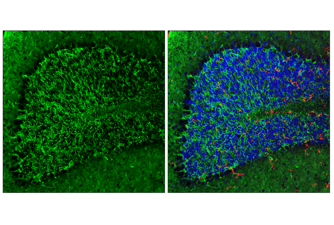 Immunofluorescence Image 1: AQP4 (E8W5A) Mouse Monoclonal Antibody