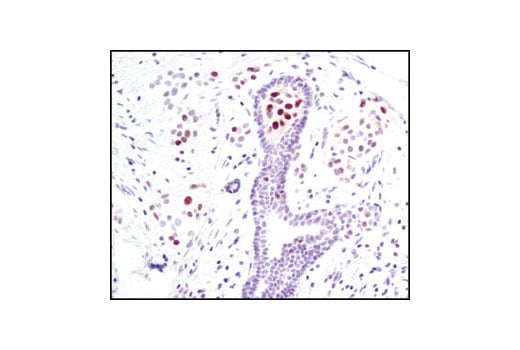 Immunohistochemistry Image 1: Phospho-Stat5 (Tyr694) (C11C5) Rabbit Monoclonal Antibody