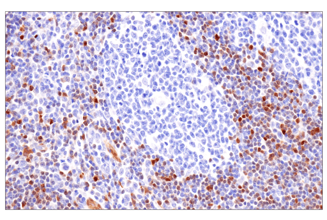 Immunohistochemistry Image 8: PPP1R14A/CPI-17 (F1I6X) Rabbit Monoclonal Antibody