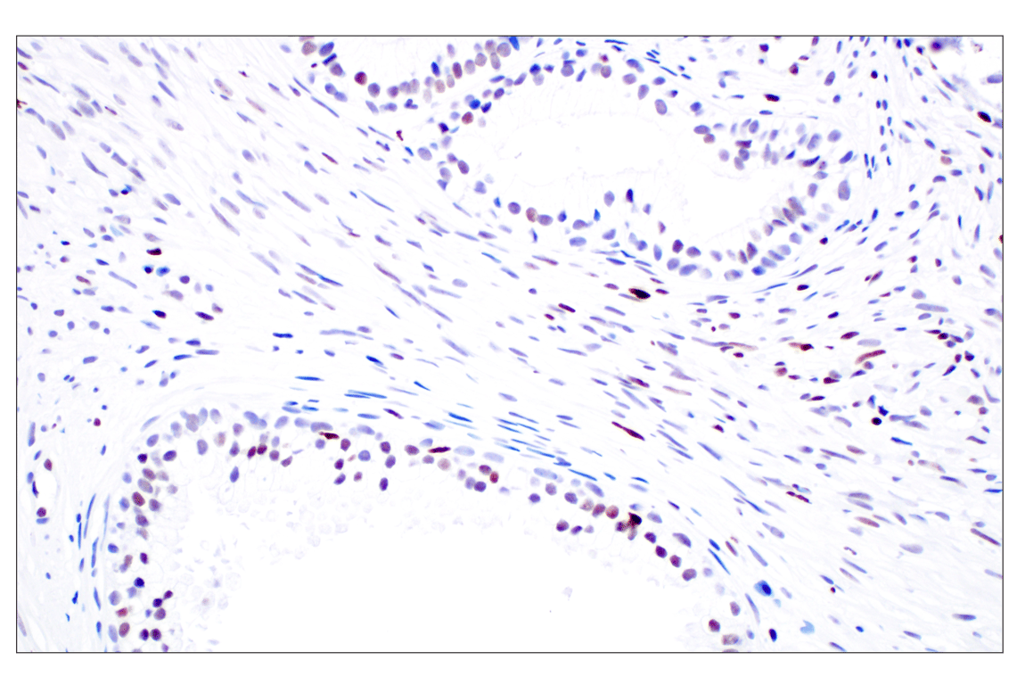 Immunohistochemistry Image 9: Phospho-Histone H3 (Ser10) (D7N8E) Rabbit Monoclonal Antibody