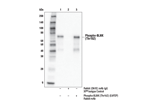 Immunoprecipitation Image 1: Phospho-BLNK (Thr152) (E4P2P) Rabbit Monoclonal Antibody