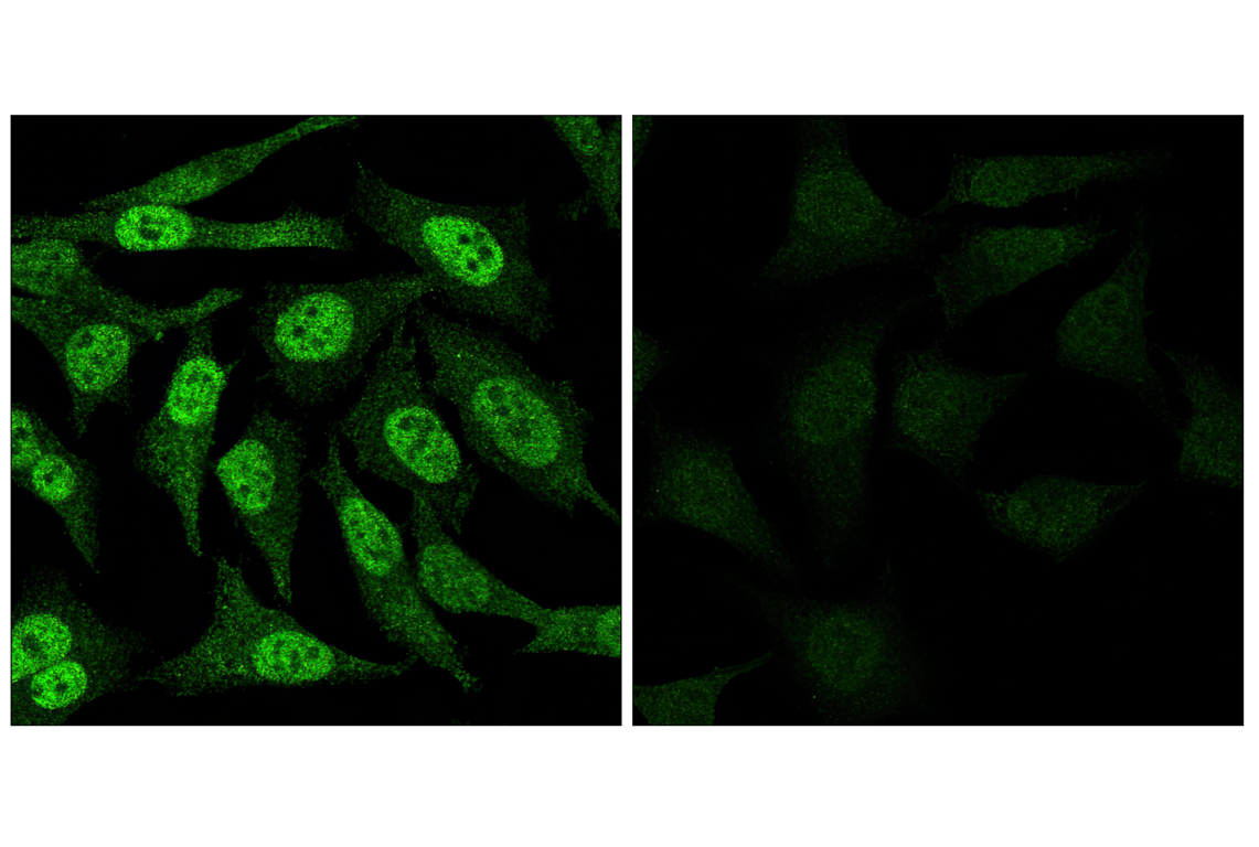Immunofluorescence Image 1: Phospho-Stat3 (Tyr705) (D3A7) Rabbit Monoclonal Antibody