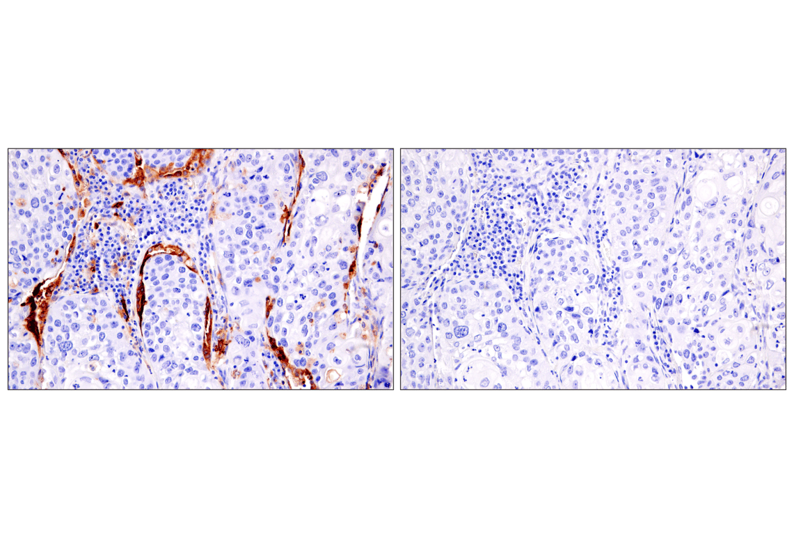 Immunohistochemistry Image 8: HLA-DRA (E9R2Q) Rabbit Monoclonal Antibody (BSA and Azide Free)