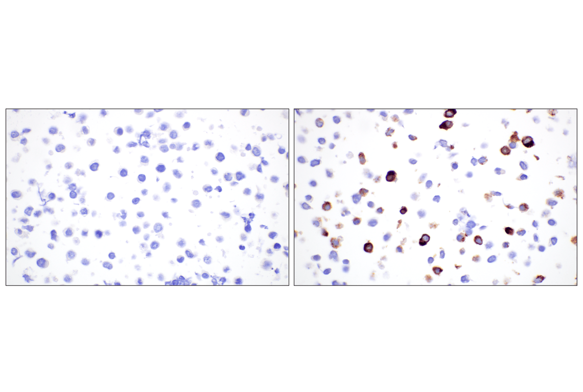 Immunohistochemistry Image 12: Mast Cell Chymase/CMA1 (F6S4Q) Rabbit Monoclonal Antibody