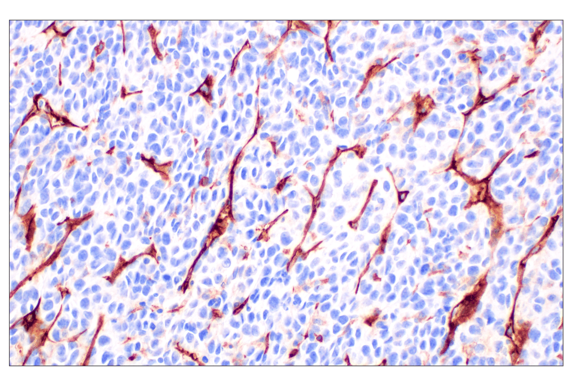 Immunohistochemistry Image 6: NT5E/CD73 (D7F9A) Rabbit Monoclonal Antibody