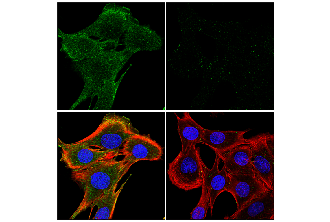 Immunofluorescence Image 1: Phospho-Akt (Ser473) (E4U3U) Mouse Monoclonal Antibody