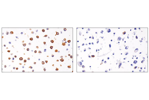 Immunohistochemistry Image 4: RHAMM/CD168 (E7S4Y) Rabbit Monoclonal Antibody (BSA and Azide Free)