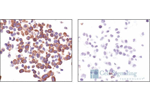 Immunohistochemistry Image 5: Phospho-S6 Ribosomal Protein (Ser235/236) Antibody