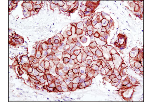 Immunohistochemistry Image 2: HER2/ErbB2 (D8F12) Rabbit Monoclonal Antibody (BSA and Azide Free)