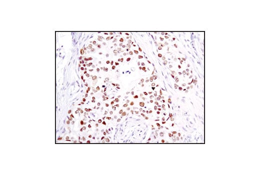 Immunohistochemistry Image 1: Chk2 (1C12) Mouse Monoclonal Antibody