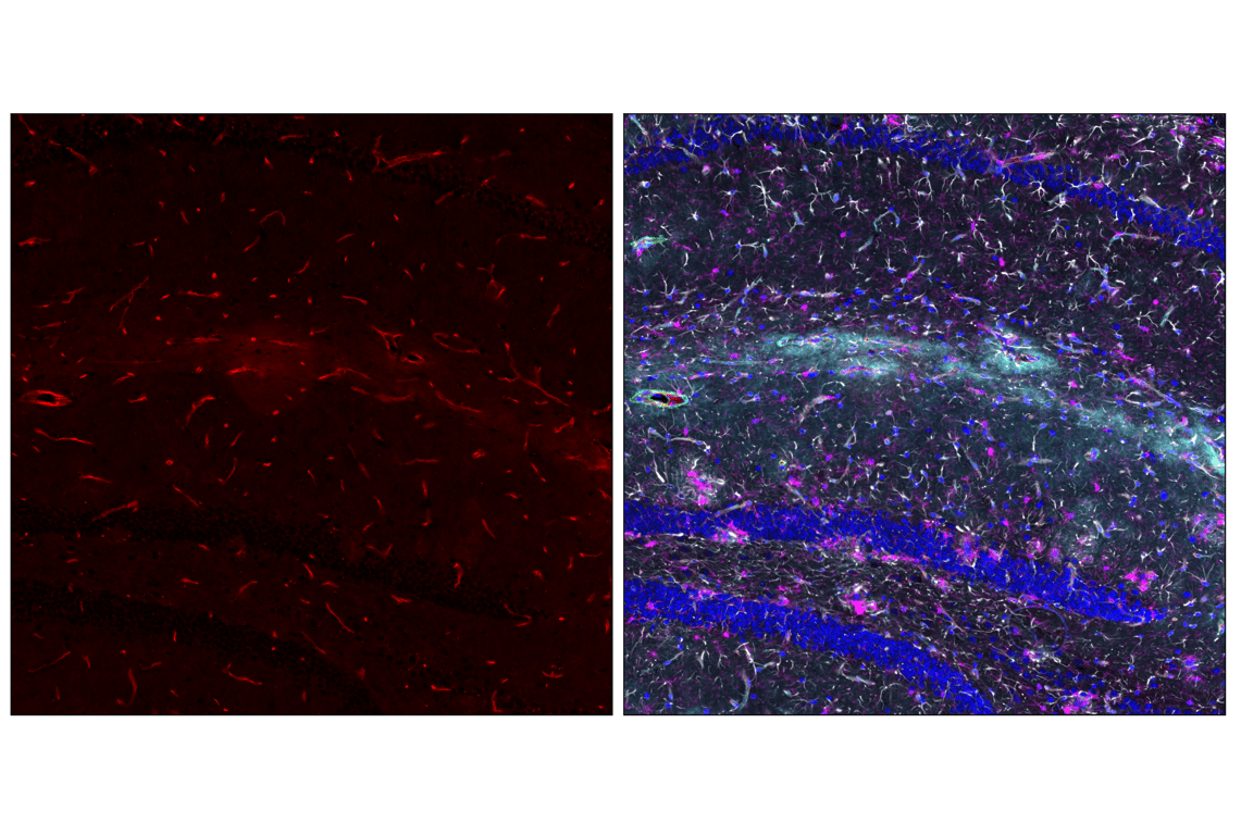Immunofluorescence Image 6: CD31 (PECAM-1) (F2N3M) Rabbit Monoclonal Antibody