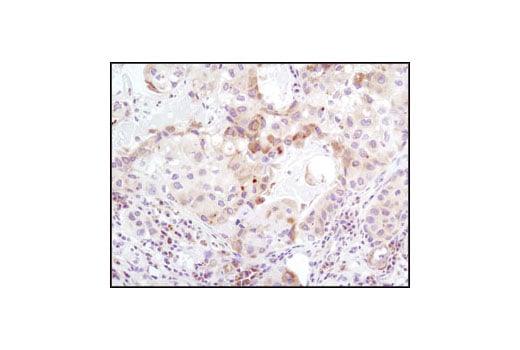 Immunohistochemistry Image 1: TRAIL (C92B9) Rabbit Monoclonal Antibody