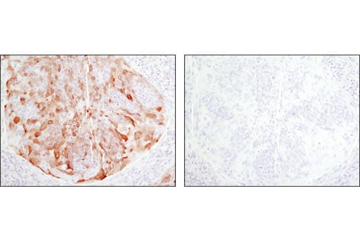 Immunohistochemistry Image 3: Phospho-NDRG1 (Thr346) (D98G11) Rabbit Monoclonal Antibody