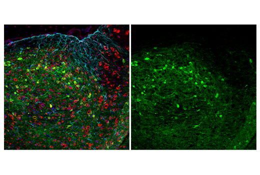Immunofluorescence Image 1: Neurogranin (E9L8D) Rabbit Monoclonal Antibody