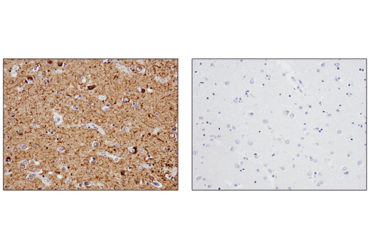 undefined Image 5: PhosphoPlus<sup>®</sup> Tau (Ser396) Antibody Duet