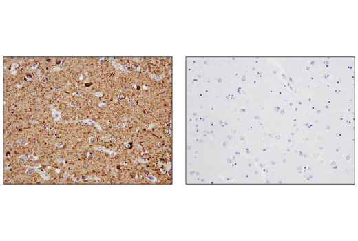 Tau (D1M9X) XP® Rabbit mAb | Cell Signaling Technology