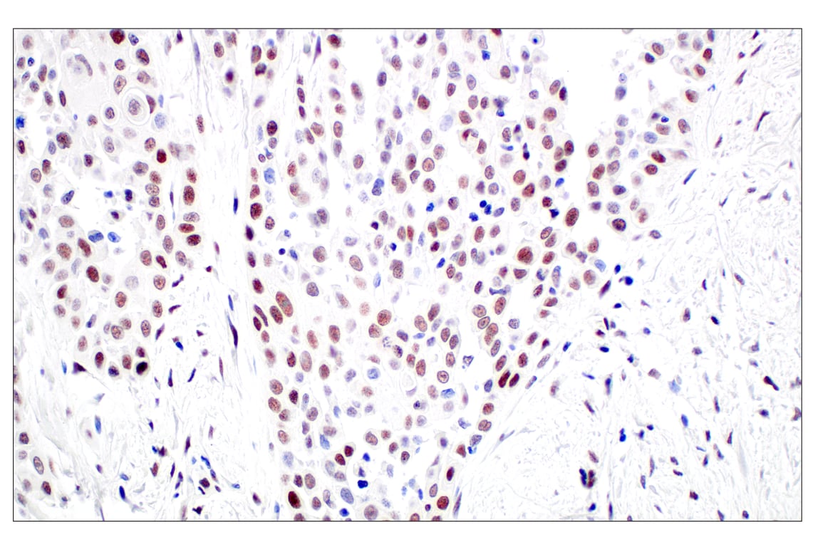 Immunohistochemistry Image 2: TCF12/HEB (E5R8X) Rabbit Monoclonal Antibody