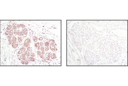 Immunohistochemistry Image 2: Thioredoxin 1 (C63C6) Rabbit Monoclonal Antibody