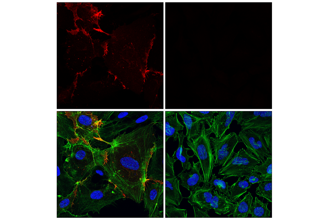 Immunofluorescence Image 1: CD31 (PECAM-1) (89C2) Mouse mAb (Alexa Fluor<sup>®</sup> 594 Conjugate)