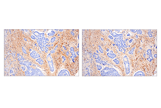 undefined Image 30: ECM Profiling Antibody Sampler Kit