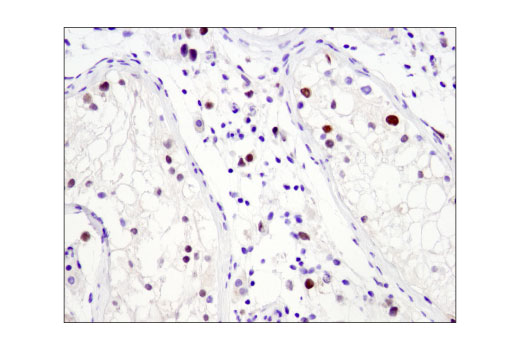 Immunohistochemistry Image 2: N-Myc (D4B2Y) Rabbit Monoclonal Antibody (BSA and Azide Free)