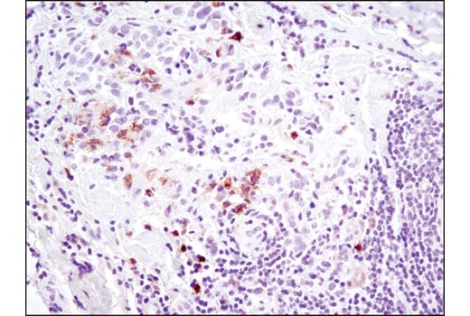 Immunohistochemistry Image 3: Axl (C89E7) Rabbit Monoclonal Antibody (BSA and Azide Free)