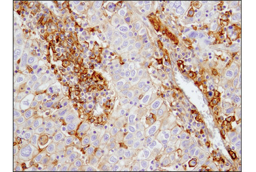 Immunohistochemistry Image 1: CD40 (D8W3N) Rabbit Monoclonal Antibody