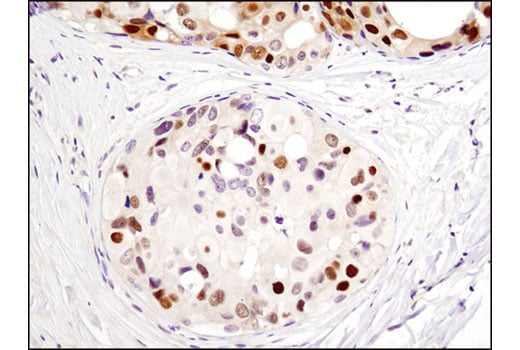 Immunohistochemistry Image 1: CDK4 (D9G3E) Rabbit Monoclonal Antibody