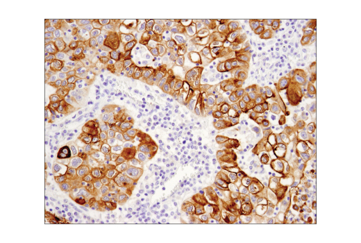 Immunohistochemistry Image 4: MUC1-C (D5K9I) Rabbit Monoclonal Antibody