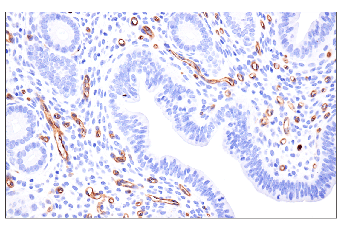 Immunohistochemistry Image 5: ESAM (F9D9P) Rabbit Monoclonal Antibody
