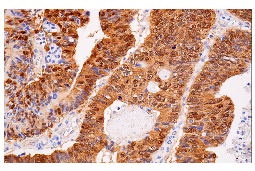 Immunohistochemistry Image 2: beta-Catenin (15B8) Mouse Monoclonal Antibody