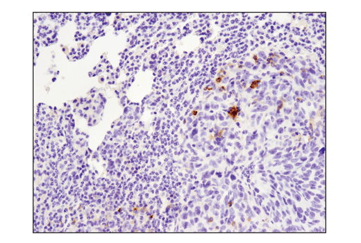 Immunohistochemistry Image 3: PD-L1 (D5V3B) Rabbit Monoclonal Antibody