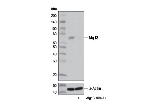 Western Blotting Image 3: Atg13 (D4P1K) Rabbit Monoclonal Antibody